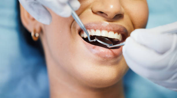 Best Emergency Dentist for Lost Fillings or Crowns in Karnes City, TX