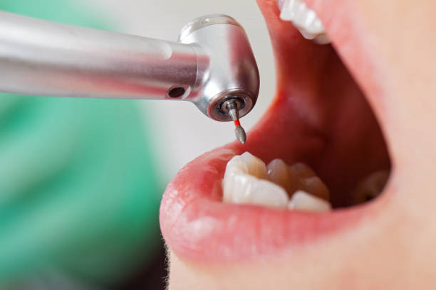 Best Pediatric Emergency Dentist in Karnes City, TX